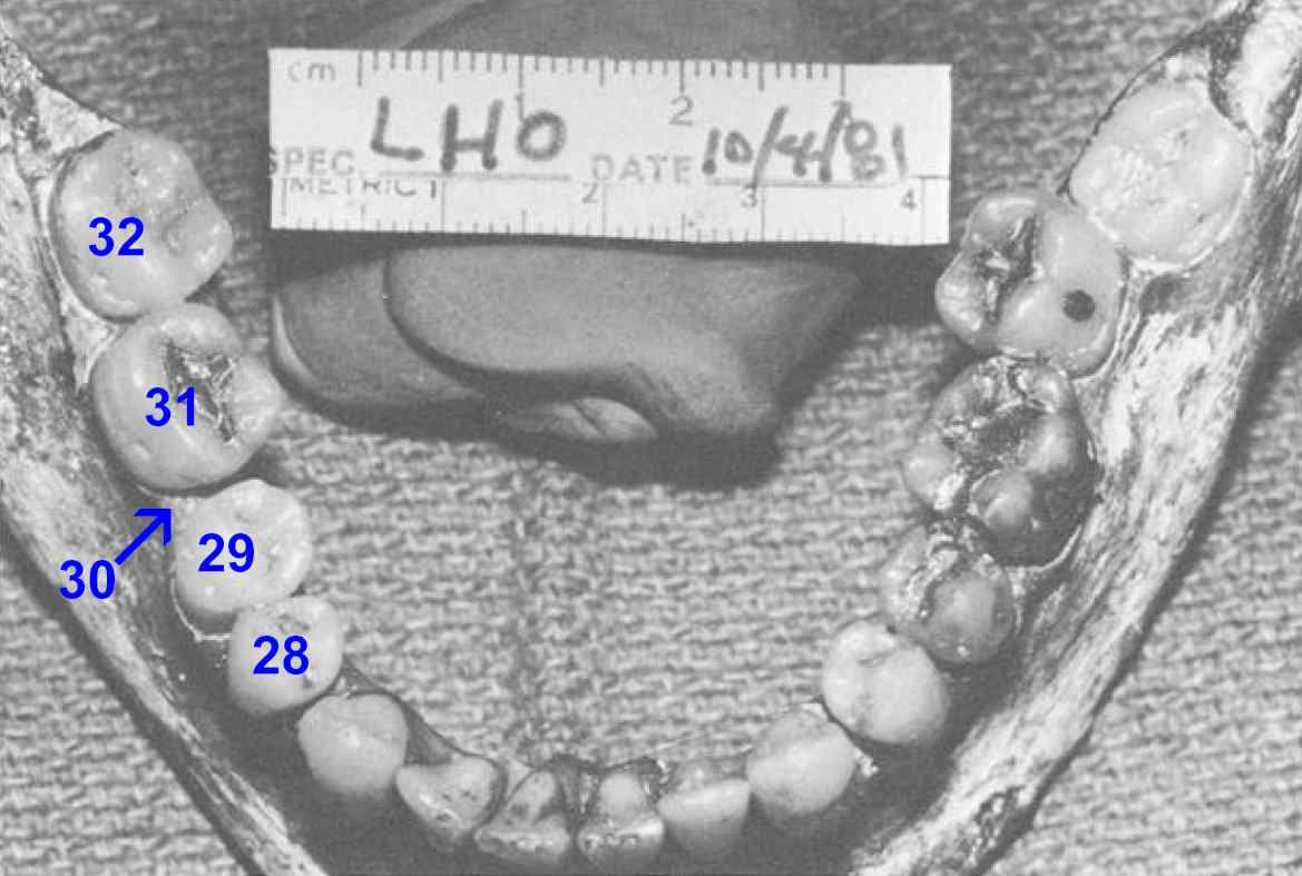 teeth_bottom_numbered.jpg